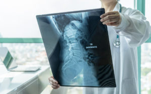 What is the Structure and Function of Your Spinal Cord?