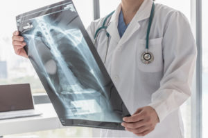 Chest Injury