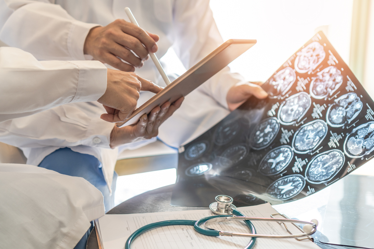 4 Types of Brain Injuries And 3 Levels of Severity