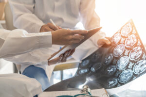 What Happens During a Concussion?
