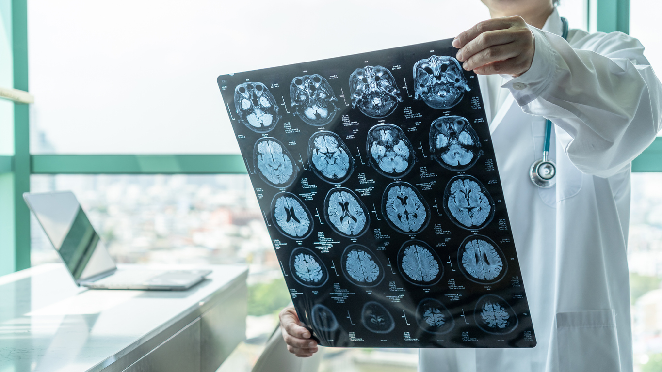 Types of Skull Fracture Injuries & Treatments